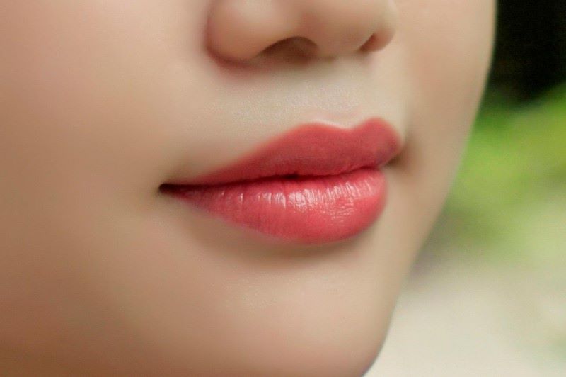 Các giai đoạn sưng tấy sau khi phun môi