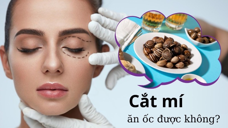 Cắt mí có được ăn ốc không