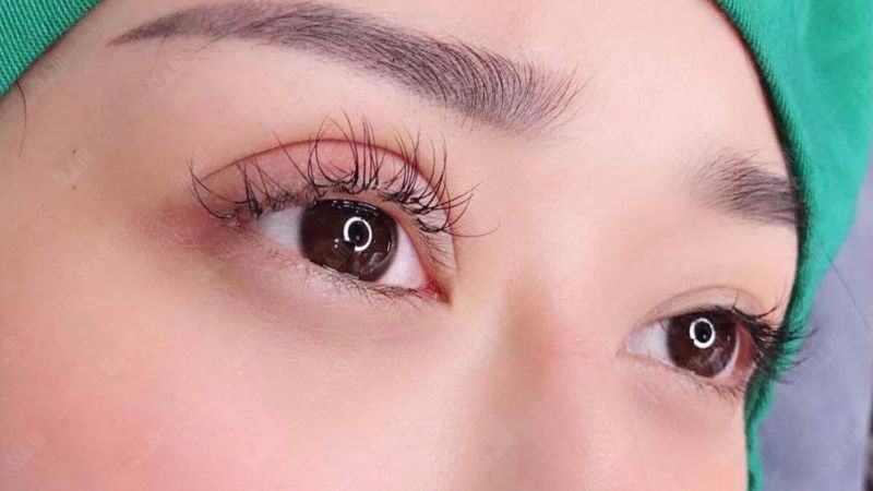 Cắt mí nên ăn gì để hồi phục nhanh chóng