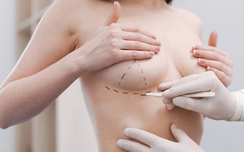 Chăm sóc sau phẫu thuật nâng ngực đường nách