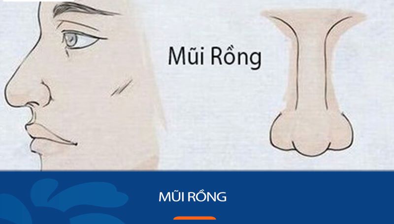 Đặc điểm của mũi rồng