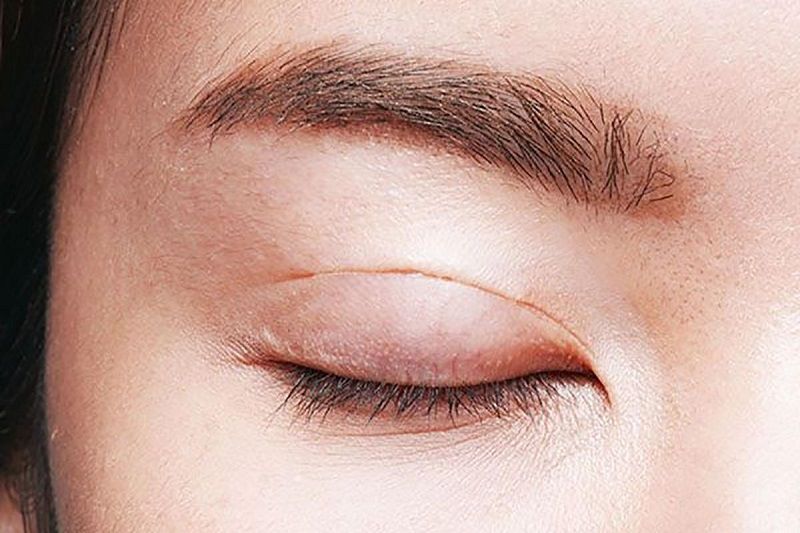 Đối tượng phù hợp với bấm mí mắt 2 mí