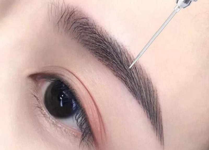 Lưu ý chế độ ăn uống để hỗ trợ phục hồi