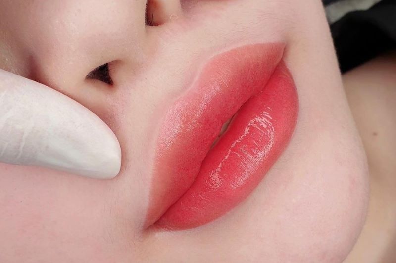 Phun môi bao lâu hết sưng và những yếu tố ảnh hưởng đến thời gian sưng