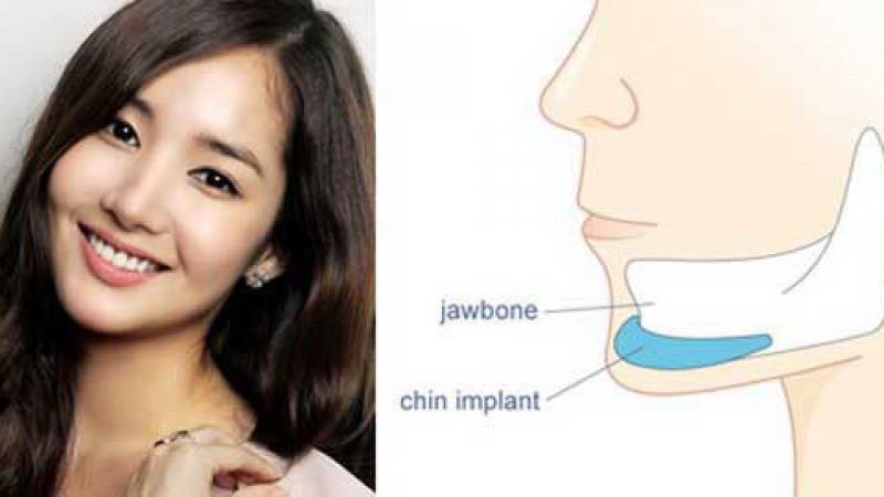Rủi ro và các yếu tố cần xem xét