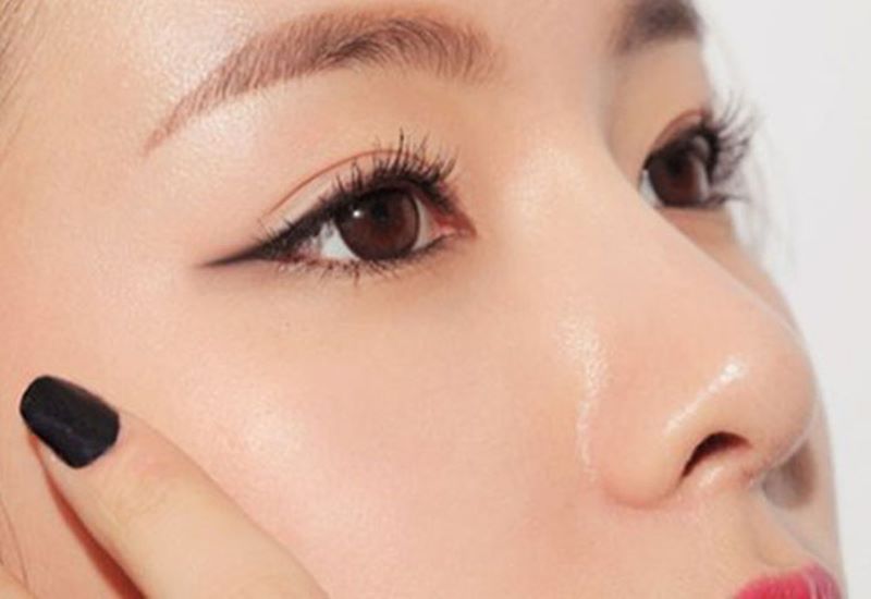 Sẹo sau phẫu thuật mở góc mắt trong có nguy hiểm không